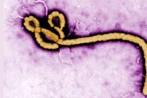 ebola